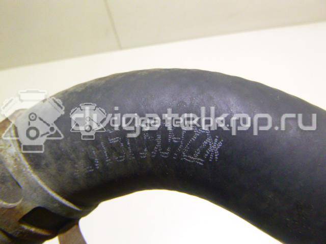 Фото Патрубок радиатора  254113X100 для kia Cerato {forloop.counter}}