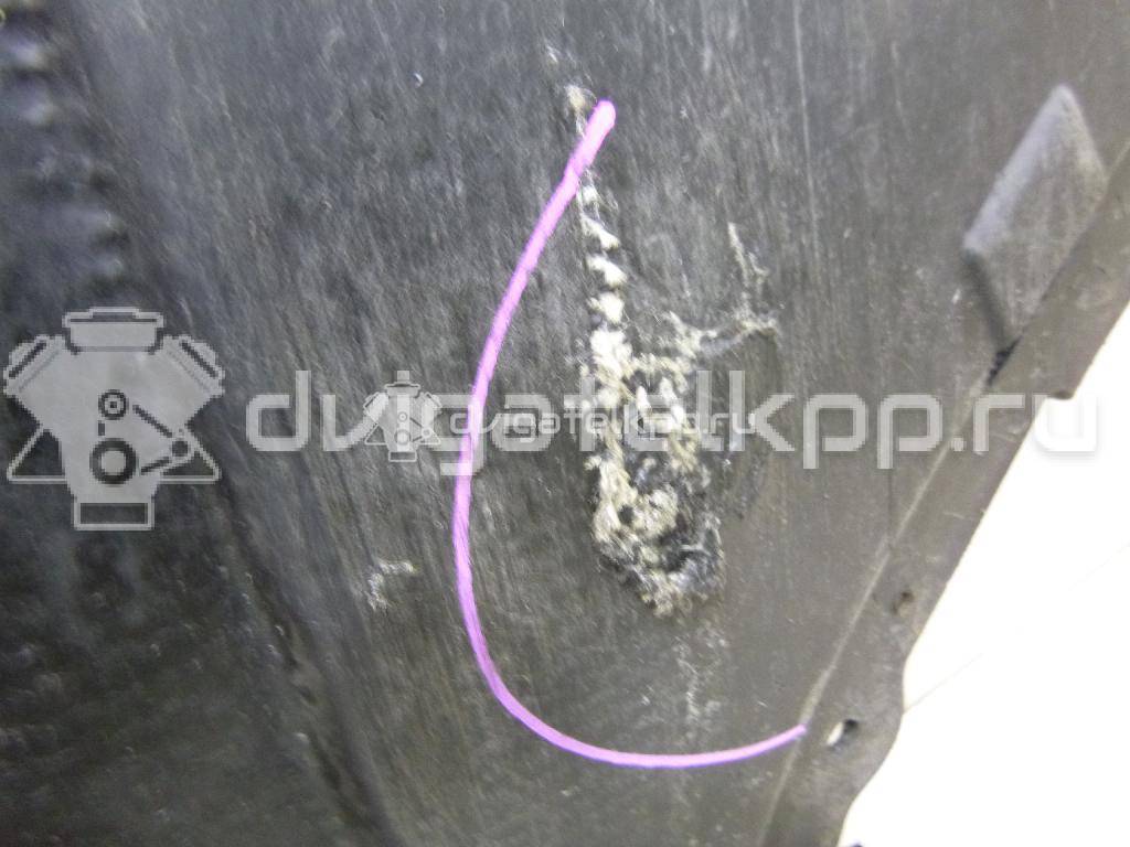 Фото Защита картера  4F0863821G для Audi A6 {forloop.counter}}